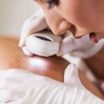 Skin Cancer Check App Cuts Referrals by 50%