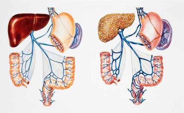 Can Supplements Harm Your Liver?