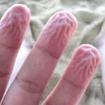 Why Your Fingers Wrinkle in Water and What It Says About Your Health