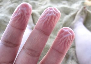 Why Your Fingers Wrinkle in Water and What It Says About Your Health