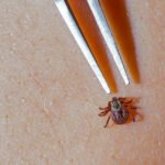 Lyme Disease Warning: The Silent Illness You Might Miss