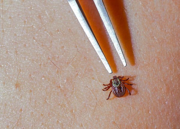 Lyme Disease Warning: The Silent Illness You Might&hellip;