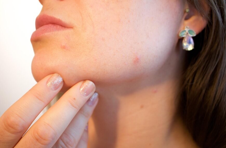 10 Skincare Habits That Can Make Your Hormonal Acne Worse