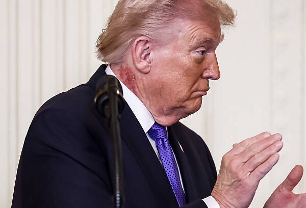 Trump’s Neck Redness Explained: What Skin Cream Reactions&hellip;