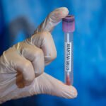 Hantavirus Myths vs Facts: 7 Myths You Should Stop Believing