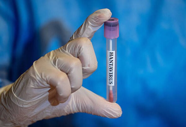Hantavirus Myths vs Facts: 7 Myths You Should&hellip;